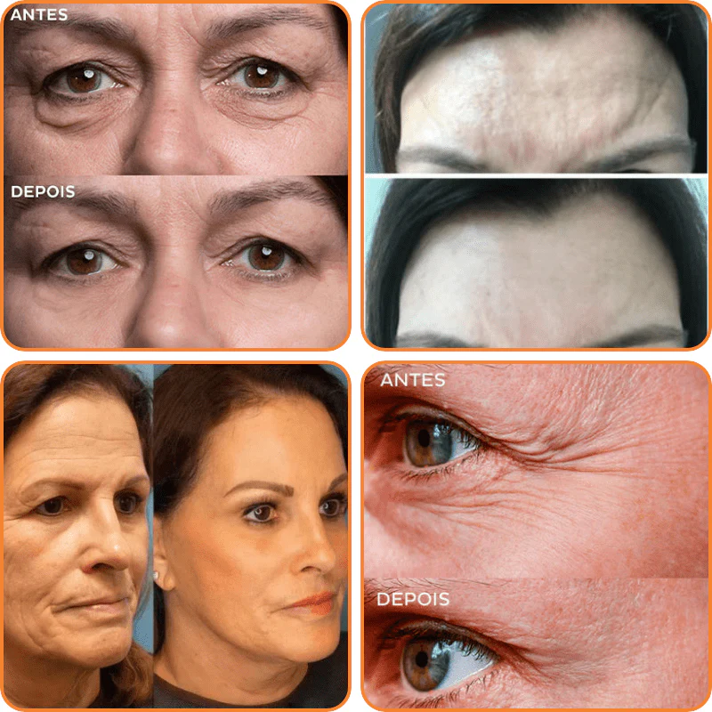 RevitaLuxe™ Mask — Unlock Instant Radiance and Timeless, Youthful Skin Without Needles - Image 3