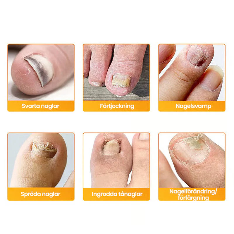 RevitaNail™ Patches — Finally Reveal Clear, Confident Nails Without the Hassle - Image 12