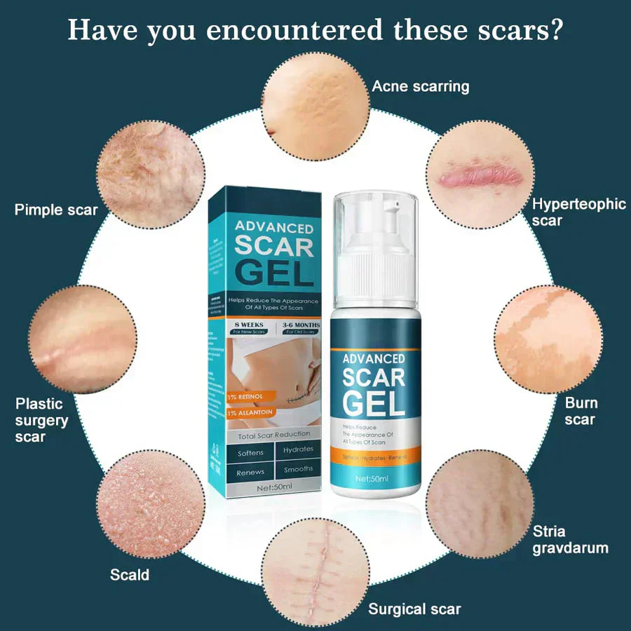 ScarEase™ — Restore Your Skin’s Smooth, Flawless Glow and Confidence - Image 5