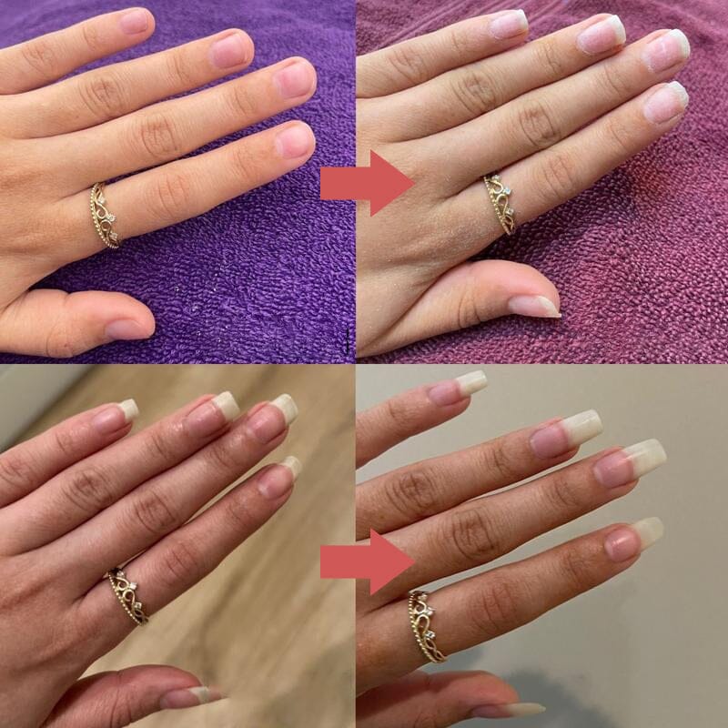 Seranail | Nail Nutrient-Rich Growth Oil - Image 9
