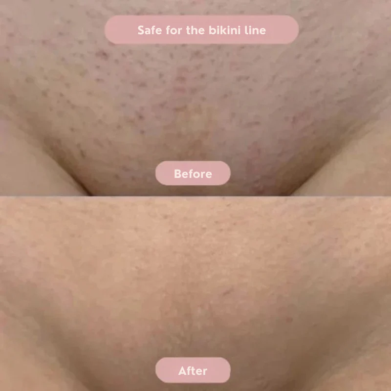 SilqSmooth™ — Glide Confidently with Silky, Irritation-Free Comfort - Image 2