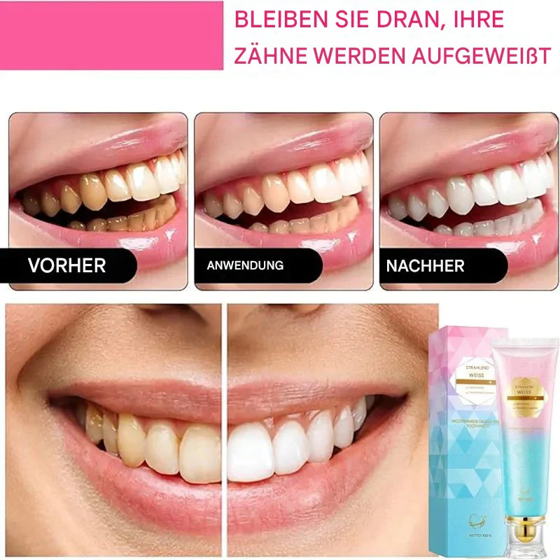 SmileVibe™ — Unlock a Stunning, Head-Turning Smile That Radiates Confidence - Image 2