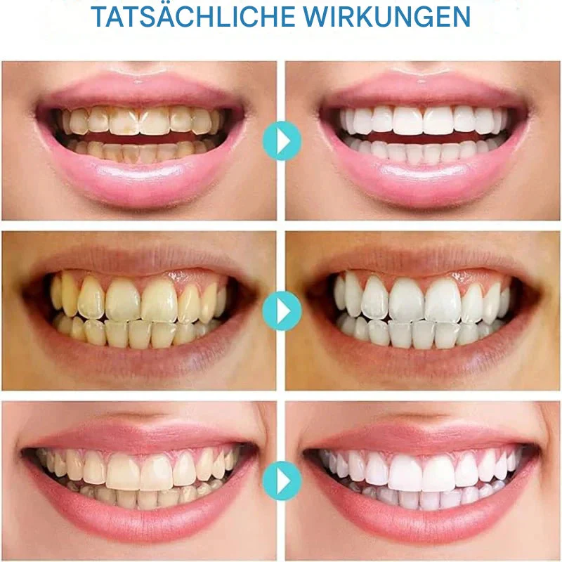 SmileVibe™ — Unlock a Stunning, Head-Turning Smile That Radiates Confidence - Image 4