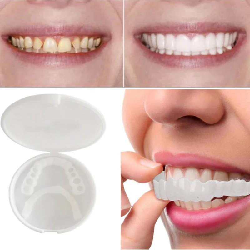 SnapBright™ — Smile Instantly with Natural-Looking Veneers | 50% Off Today - Image 4