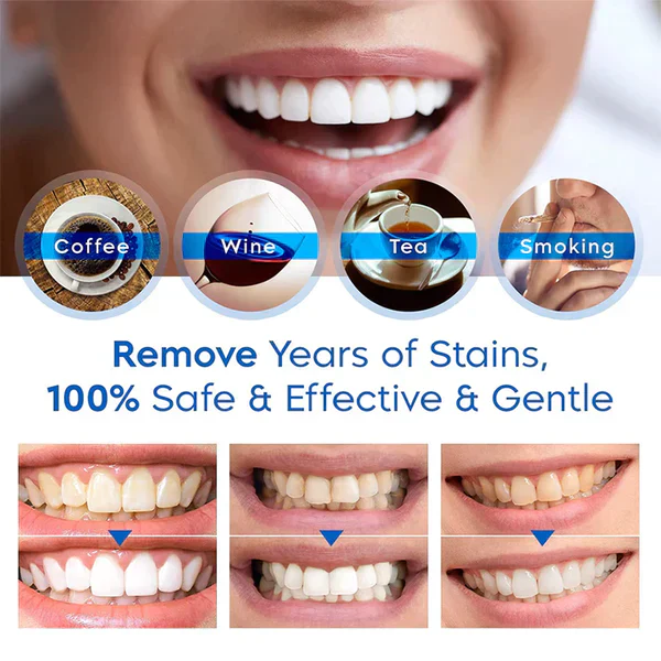Teeth Whitening Essence | From yellow to white in 30 seconds! - Image 4