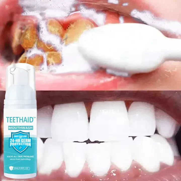 Teethaid™ Pure Herbal Teeth Whitening & Mouth Repair Mousse - Image 2