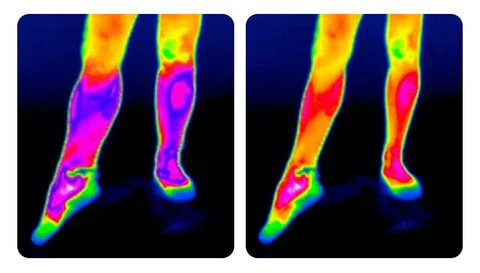 ThryvaKnee™ — Ignite Soothing Warmth for Pain-Free, Confident Movement All Day - Image 11