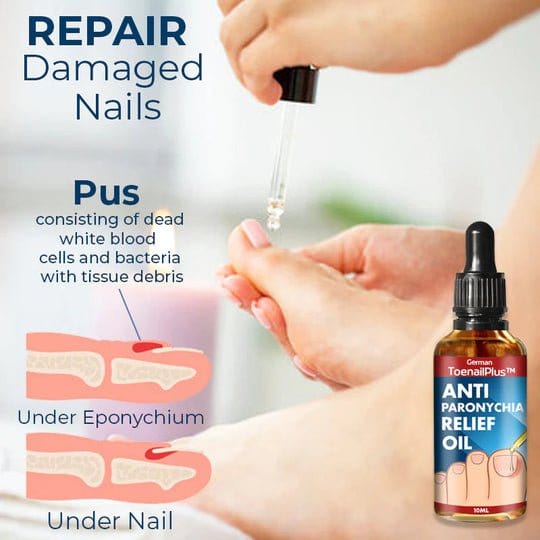 ToenailPlus™ Anti-Paronychia Relief Oil - Image 2