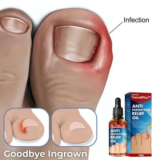 ToenailPlus™ Anti-Paronychia Relief Oil - Image 5