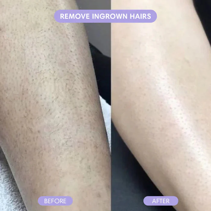 VeloraSmooth™ — Glide into Irresistibly Silky Legs Without a Single Irritation - Image 4