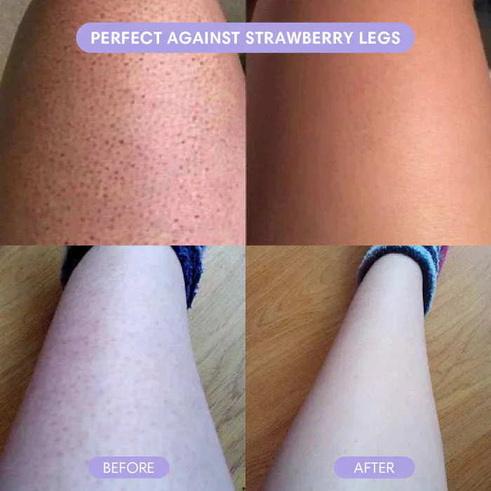 VeloraSmooth™ — Glide into Irresistibly Silky Legs Without a Single Irritation - Image 5