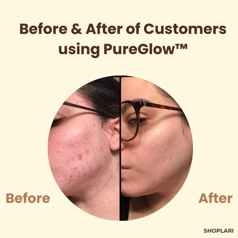 VeluxeTea™ — Unleash Radiant, Youthful Skin That Commands Admiration - Image 3
