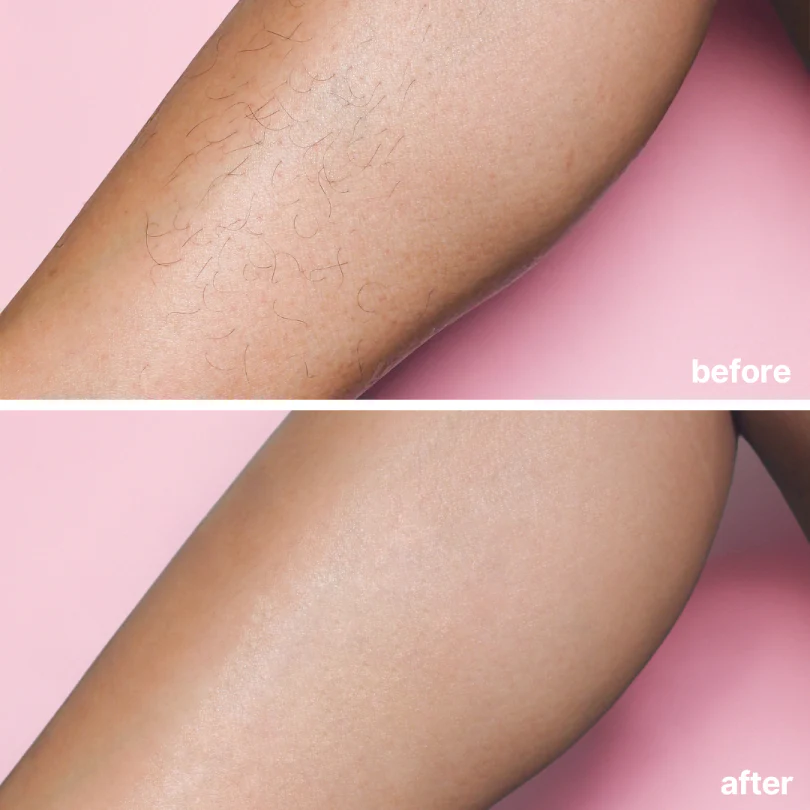 BareBasic™ No-Shave Hair Removal Cream — Smooth, Silky Skin in Minutes Without the Pain or Irritation - Image 5