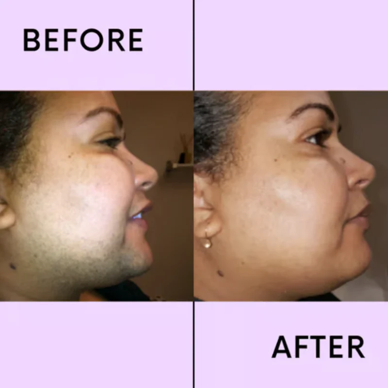 VelvetEase™ — Melt Away Facial Hair for Instantly Silky, Irritation-Free Skin - Image 6
