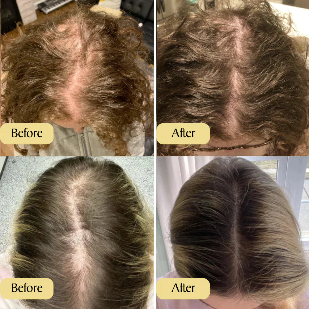 Veralyss™ Hair Elixir — Ignite Your Hair’s Natural Bounce and Brilliance in Just Weeks! - Image 5