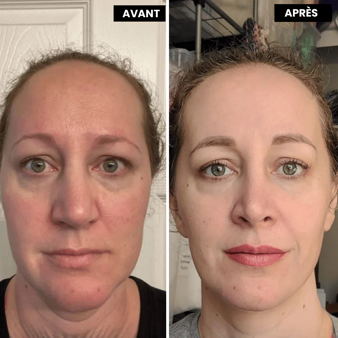 VitaFirm™ Duo — Unlock Firm, Radiant Skin That Turns Back Time - Image 10