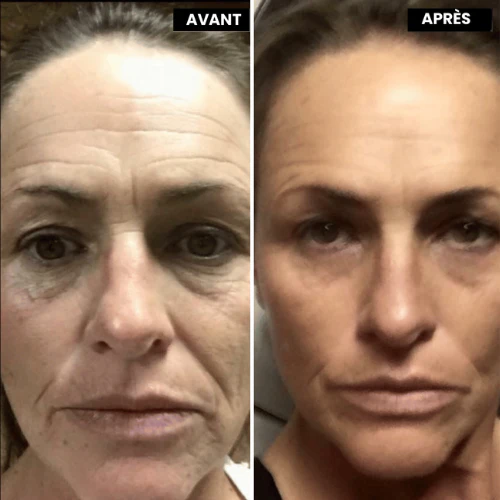VitaFirm™ Duo — Unlock Firm, Radiant Skin That Turns Back Time - Image 3