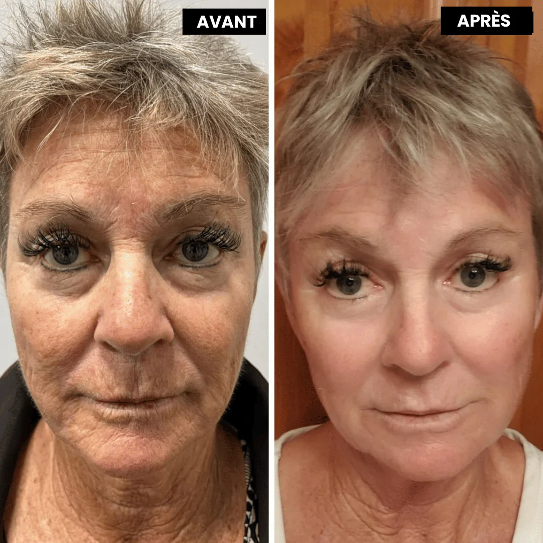 VitaFirm™ Duo — Unlock Firm, Radiant Skin That Turns Back Time - Image 5