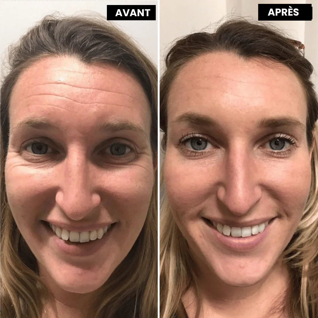 VitaFirm™ Duo — Unlock Firm, Radiant Skin That Turns Back Time - Image 9