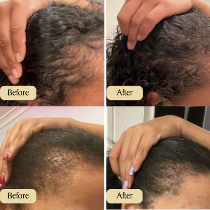 VitalBlossom™ Natural Hair Growth Oil - Image 6