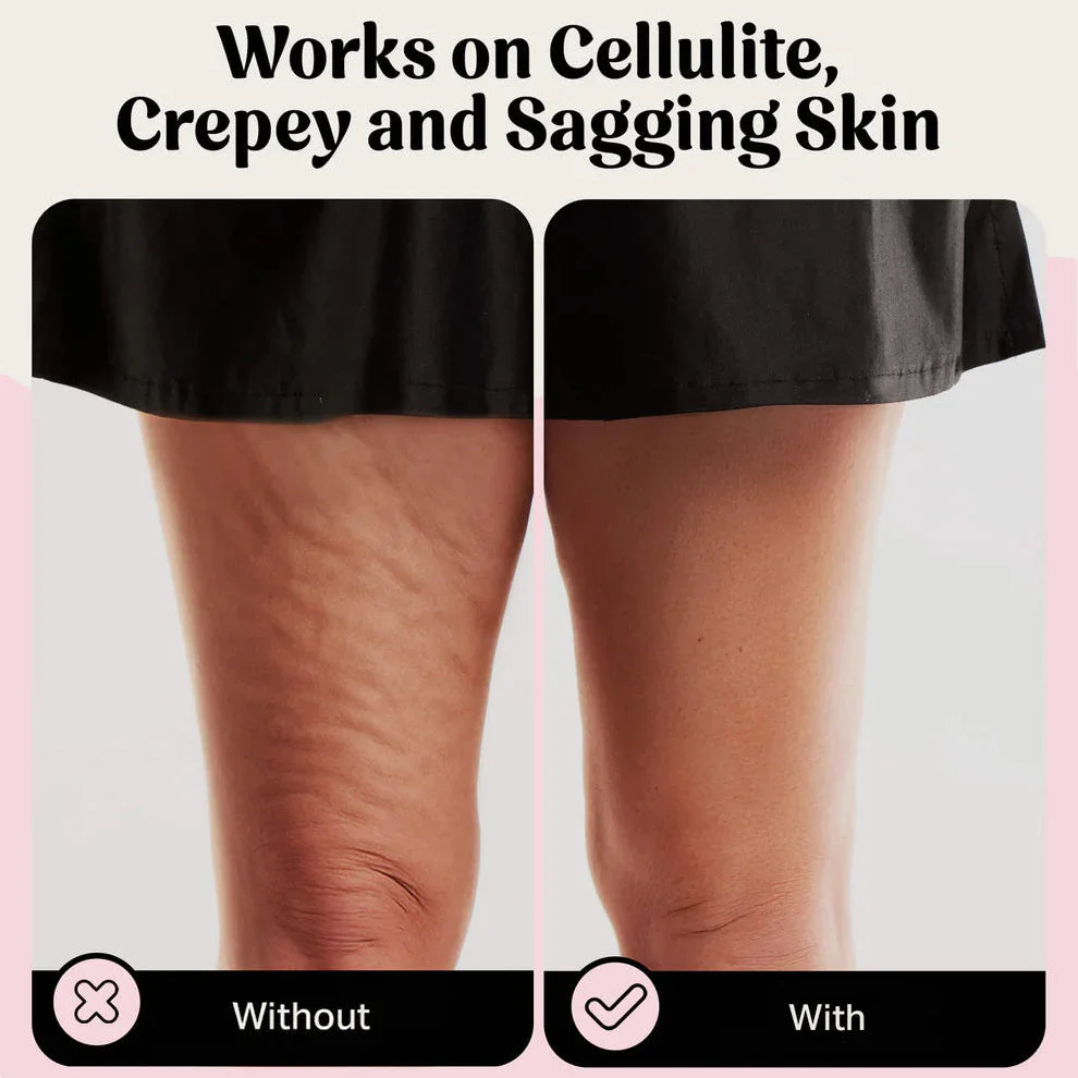 ViveLisse™ Body Tape — Instantly Smooth, Lift, and Sculpt Your Confidence in Seconds - Image 10