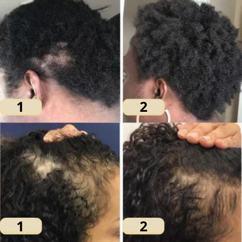 Arvilaro: Your natural oil for hair growth - Image 6