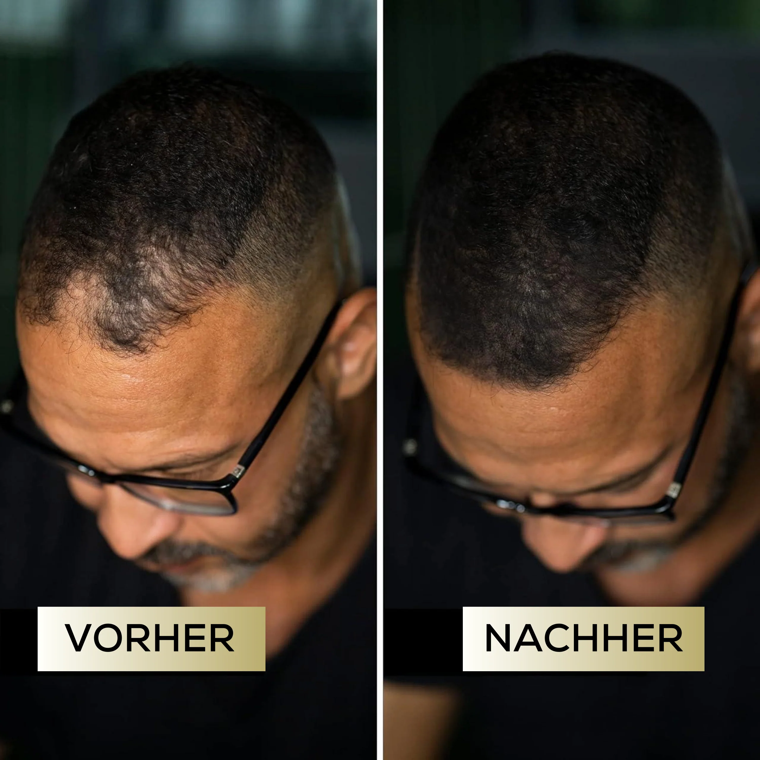 VoluMaxx™ — Instantly Unlock Lush, Confident Hair That Stays Flawless All Day - Image 2